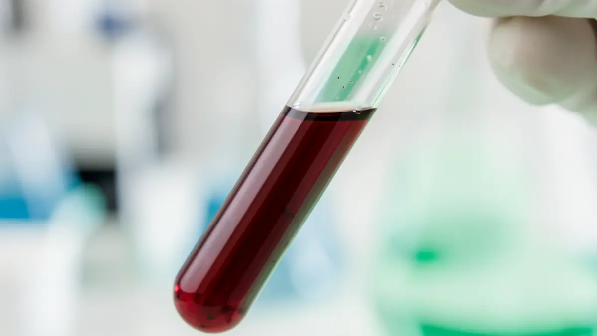 Muestra de sangre en un tubo de ensayo para análisis científico.